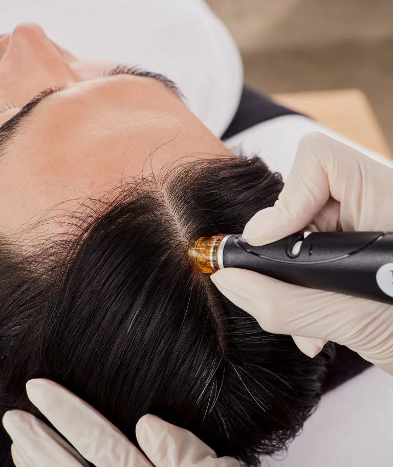 Benefits of Keravive Scalp Treatment