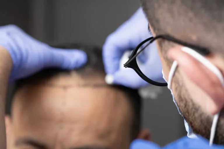 Hair transplantation